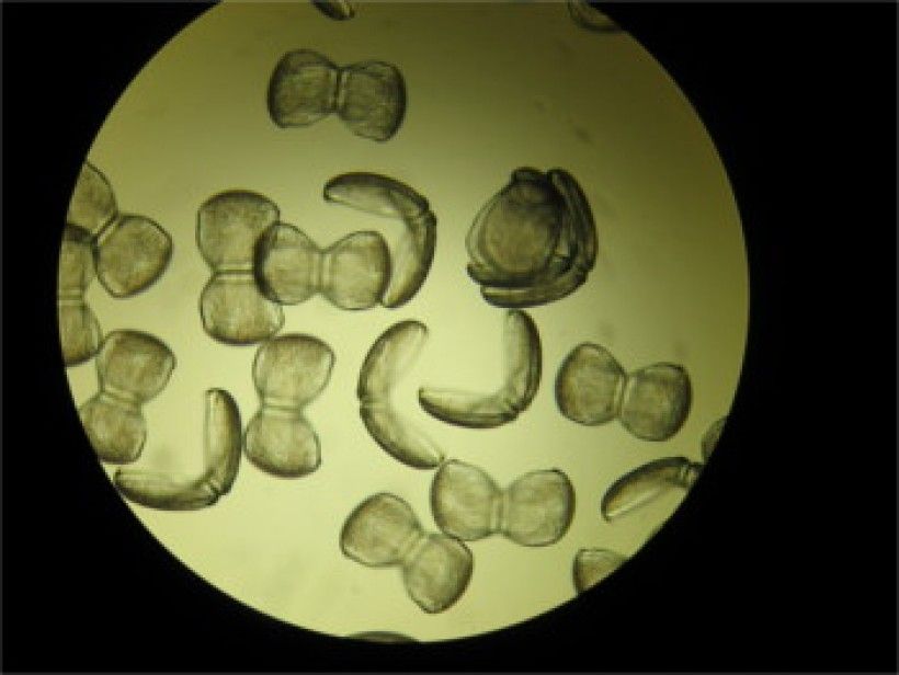 Glochidia are microscopic mussel larvae that begin their lives as parasites.